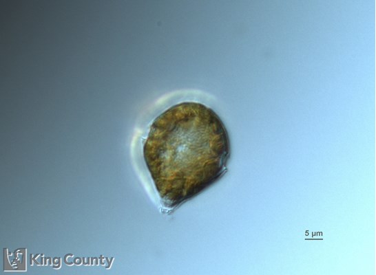 Photo of Scrippsiella trochoidea